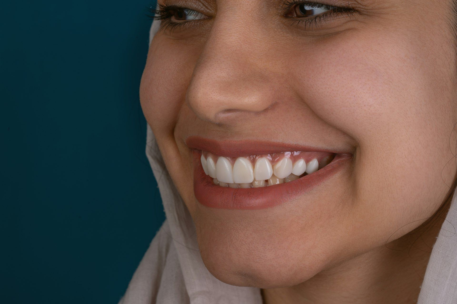 Sonrisa radiante con carillas dentales - Smile Clinica Dental
